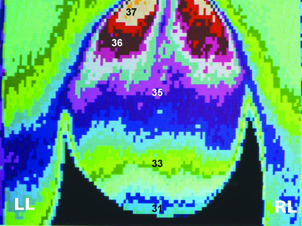 Pic 2 thermoregulation of testis