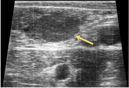 Ultrasonographybovineovary4